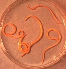 طفيليات رجل أسكاريد