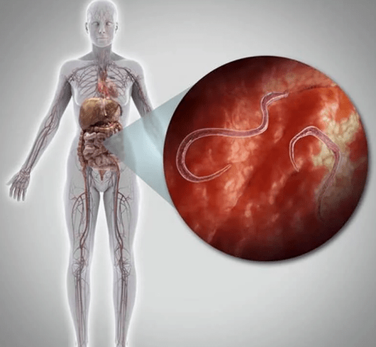 الطفيليات في جسم الإنسان