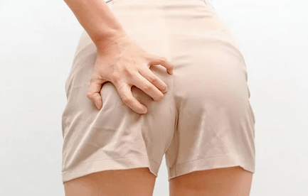 الحكة الشرج