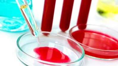 اختبار الدم للطفيليات