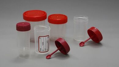 كيفية الاستعداد لاختبار الطفيليات