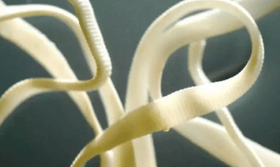 كيفية إزالة الطفيليات من جسم الإنسان