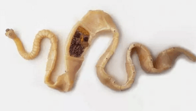 كيفية اكتشاف وجود الطفيليات في الجسم